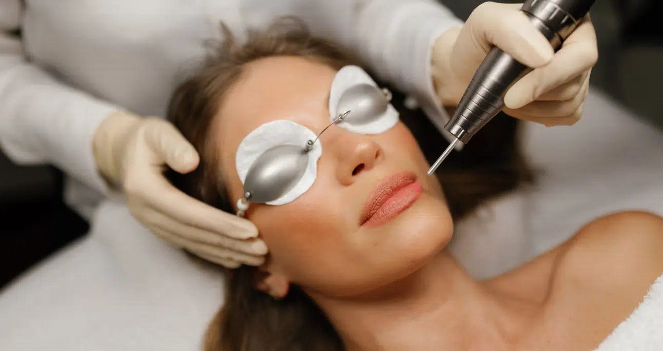 Skin Laser Treatment